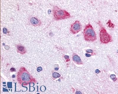 PathPlus™ TAOK1 / TAO1 Antibody (Internal)