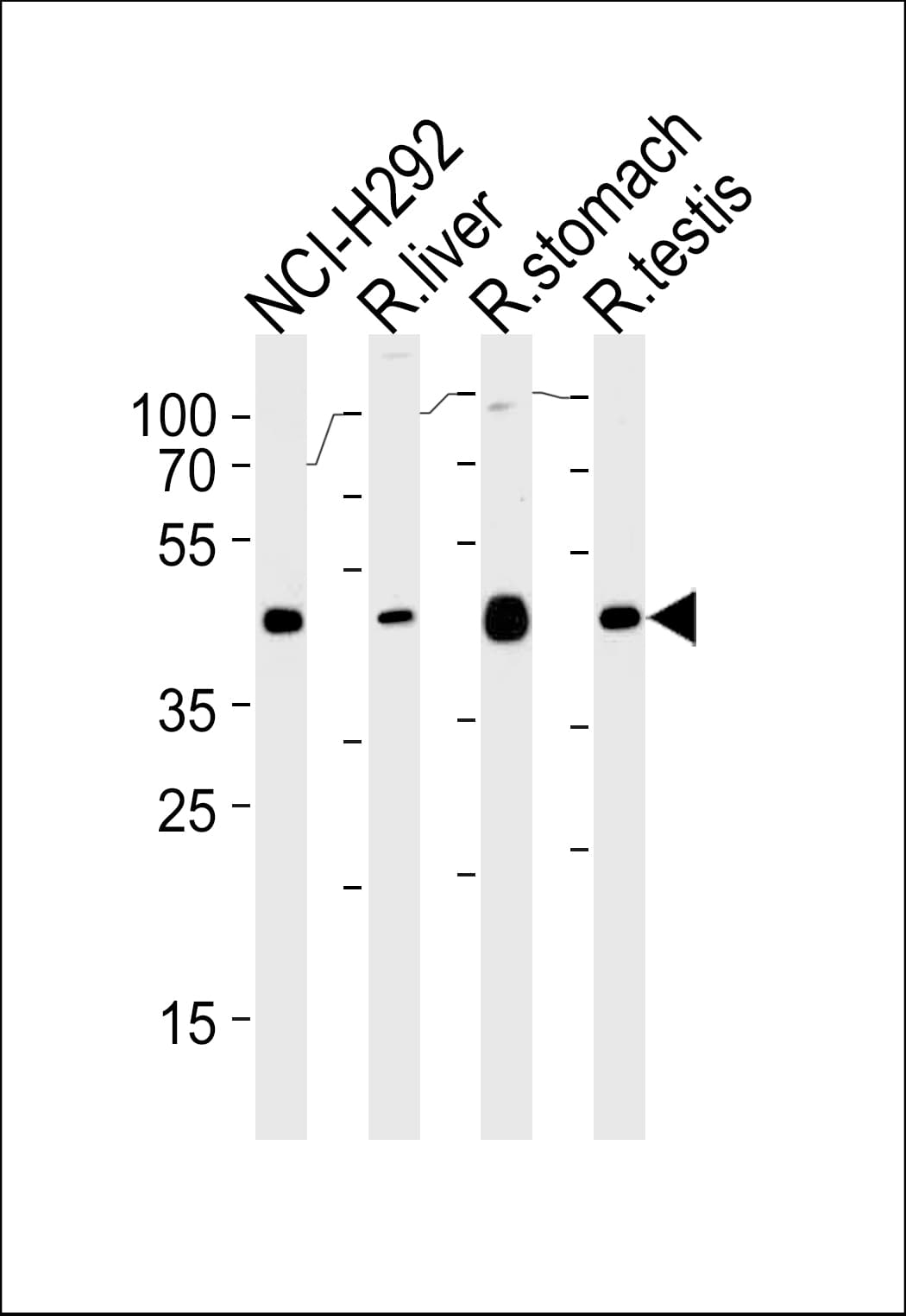 Polyclonal Rabbit anti-Human PCGF6 Antibody (aa190-217, WB)