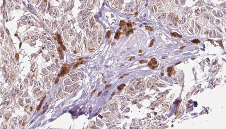 UEVLD Antibody