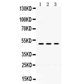 Polyclonal Rabbit anti-Human OMG / OMGP Antibody (aa64-99, WB)