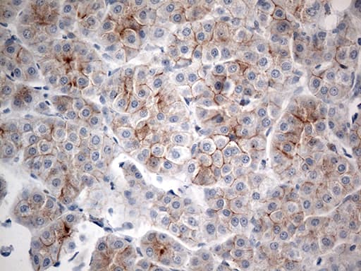 CRF2-12 / IL28RA Antibody (aa21-228, clone OTI8G1)