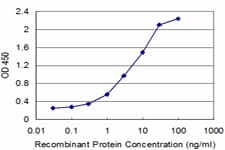 Monoclonal Mouse anti-Human RFC1 / RFC Antibody (clone 3F8, WB)