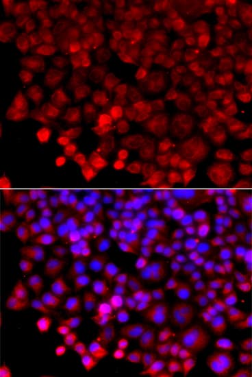 HARS Antibody