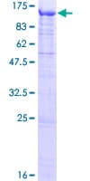 Human FSTL5 Protein (Recombinant GST)