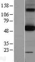 Human OXCT1 Protein (Over-Expression Lysate Myc-DDK (Flag))