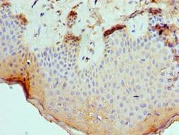 SLURP1 / ARS / MDM Antibody (aa1-103)