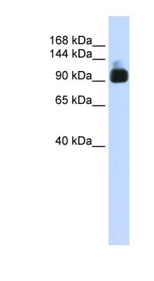 ACTN3 Antibody (aa180-229)