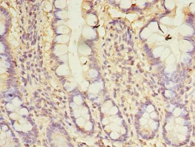 IHC-plus™ CXCL6 Antibody