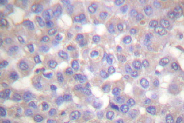 Polyclonal Rabbit anti-Human TH / Tyrosine Hydroxylase Antibody (Gln25, IHC, WB)