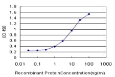 CYP1B1 Antibody (clone 2F8)