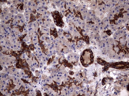KRT7 / CK7 / Cytokeratin 7 Antibody (clone OTI2A2)