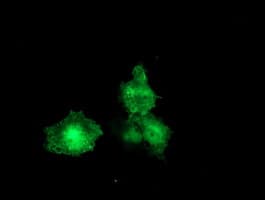 F13A1 / Factor XIIIa Antibody (clone OTI9E2)