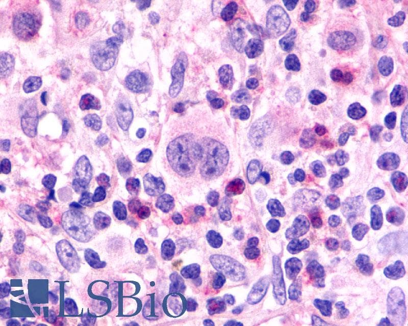 PathPlus™ CCR7 Antibody (C-Terminus)