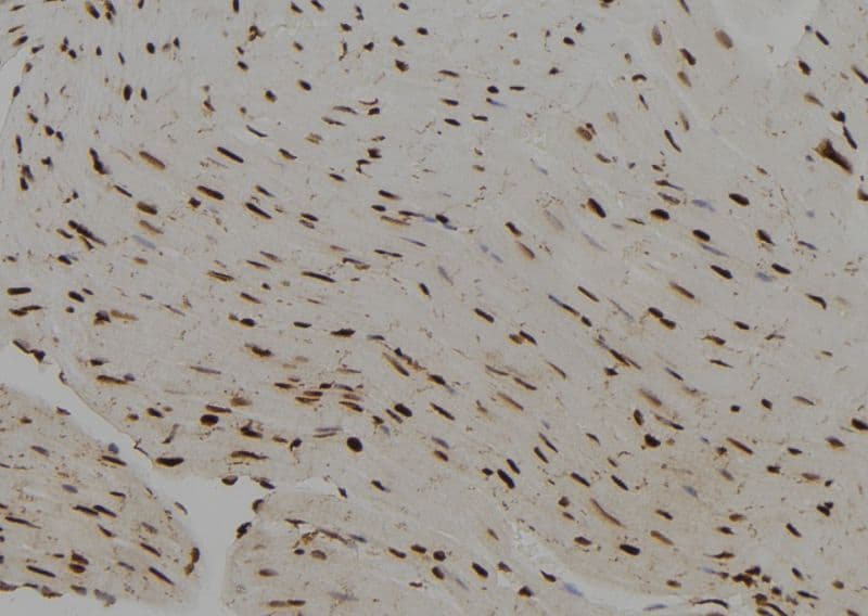 PRRX2 / PRX2 Antibody