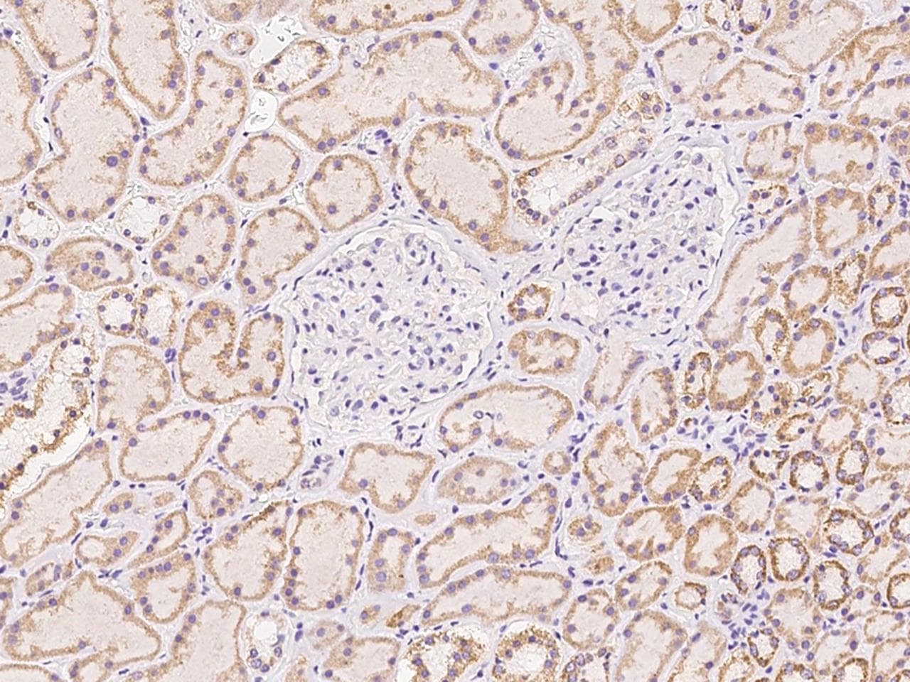 C21orf62 Antibody