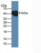 KRT14 / CK14 / Cytokeratin 14 Antibody (aa111-418)