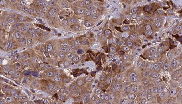 DRD5 / Dopamine Receptor D5 Antibody