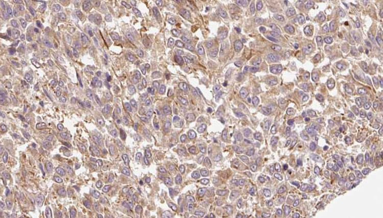 ARSK / Arylsulfatase K Antibody
