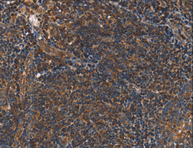 PLIN2 / ADFP / Adipophilin Antibody