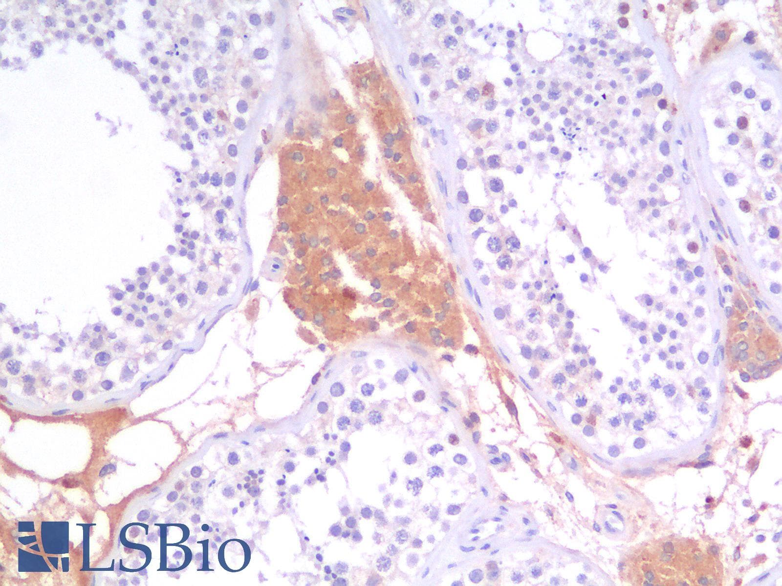 PathPlus™ Recombinant Monoclonal Mouse anti-Human CD44 Antibody (clone rCD44v9/1459, IHC)