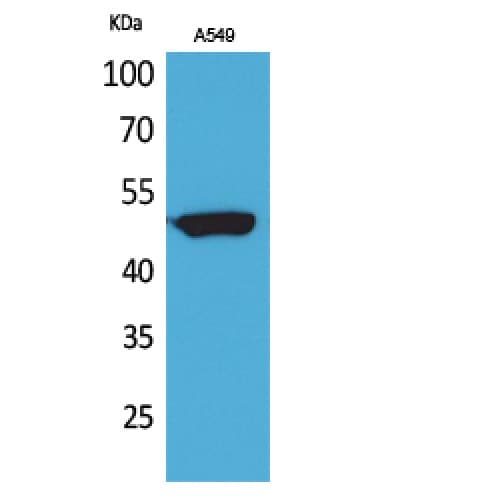 Polyclonal Rabbit anti-Human FOXA1 + FOXA2 + FOXA3 Antibody (WB)