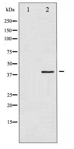 Polyclonal Rabbit anti-Human HNRNPC / HNRNP C Antibody (phospho-Ser260, IHC, WB)
