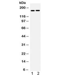 CP / Ceruloplasmin Antibody