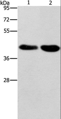 DRAK1 / STK17A Antibody