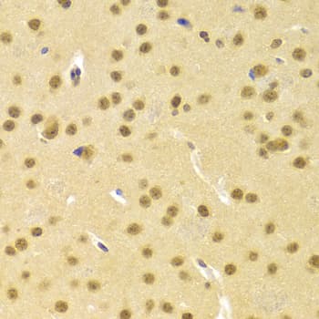 Polyclonal Rabbit anti-Human CBFB Antibody (IHC, IF, WB)