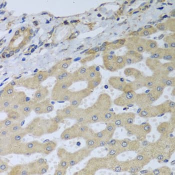 Polyclonal Rabbit anti-Human ATAD3B Antibody (IHC, WB)
