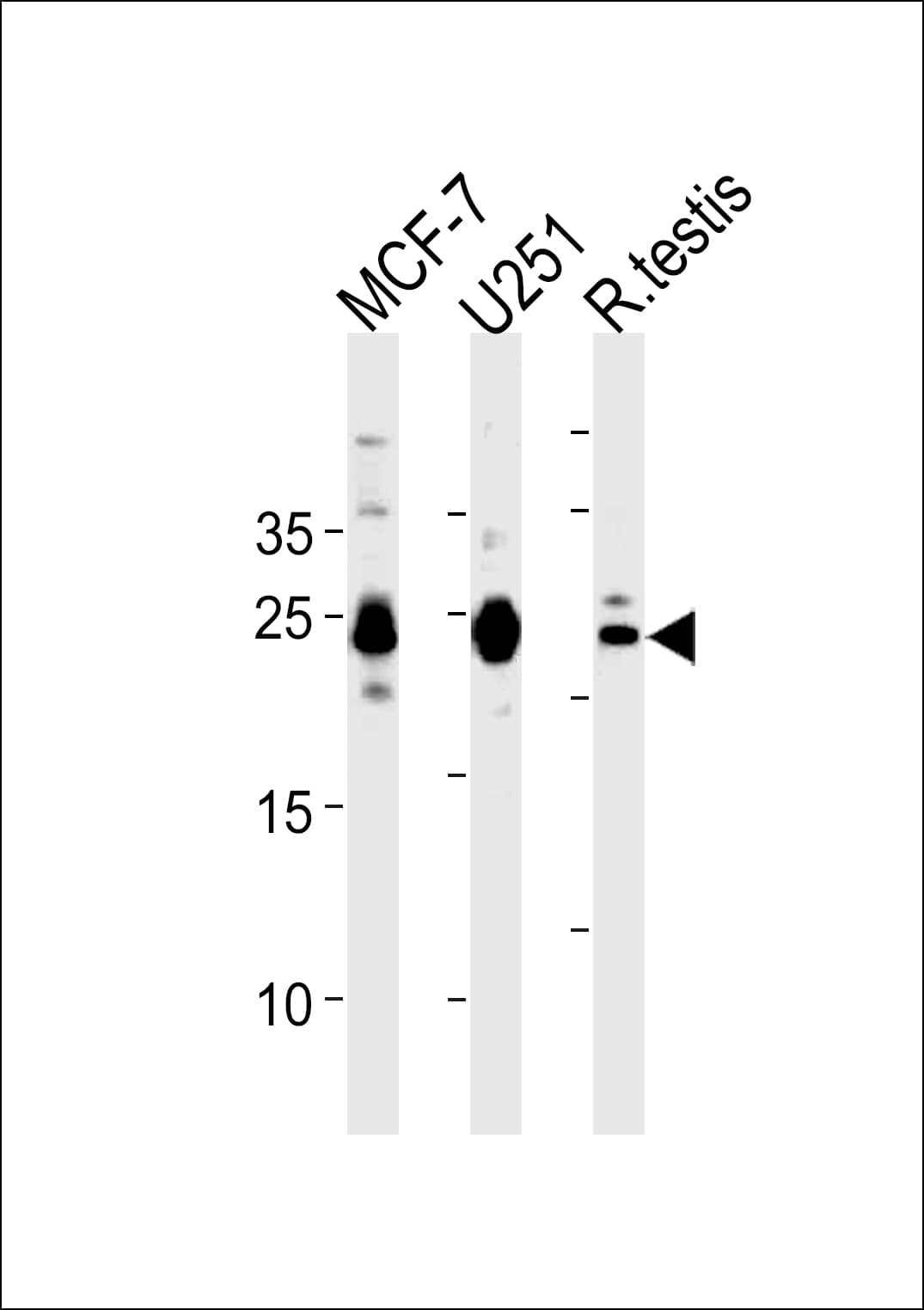 GFER Antibody (aa67-94)