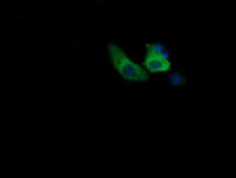 Monoclonal Mouse anti-Human COG6 Antibody (clone OTI1B8, IHC, IF, WB)