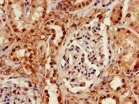Polyclonal Rabbit anti-Human TIP48 / RUVBL2 Antibody (IHC, WB)