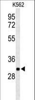 PGP Antibody (aa33-62)