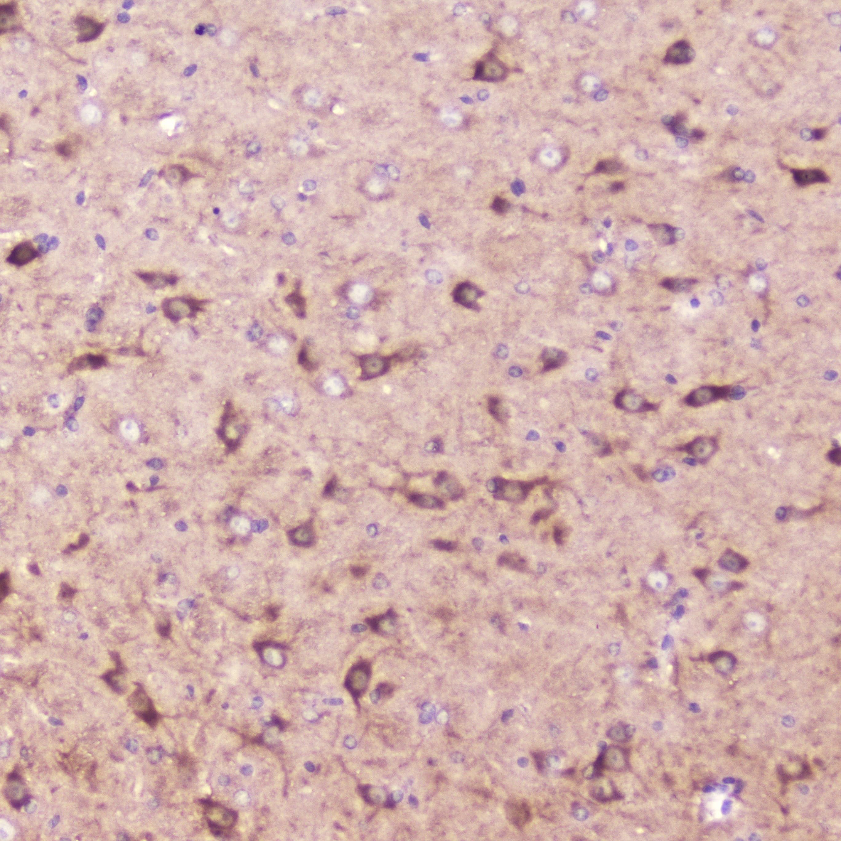 IGFBP2 / IGF-BP53 Antibody