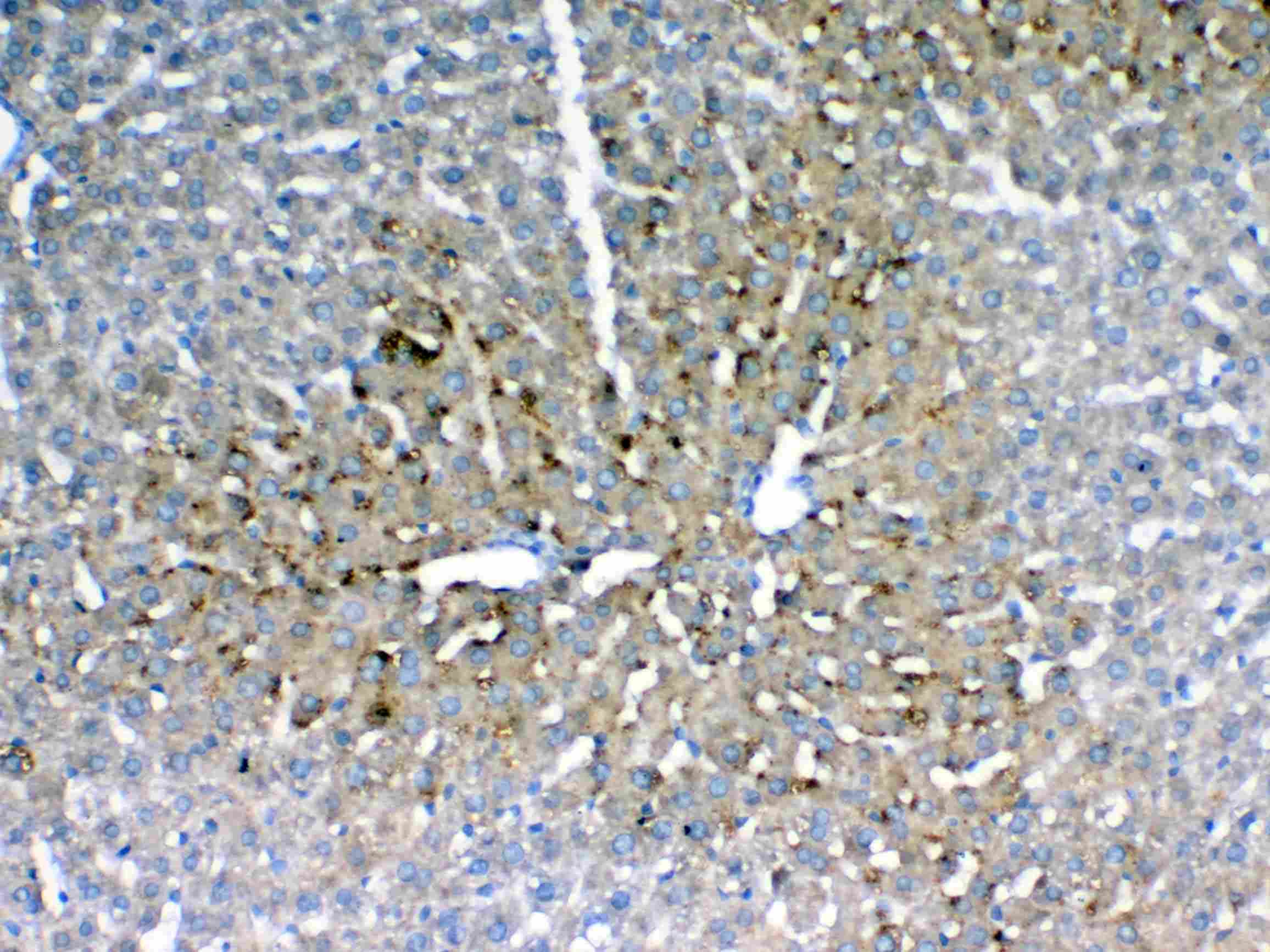IGFBP1 Antibody