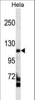 FAM65C Antibody (aa700-729)