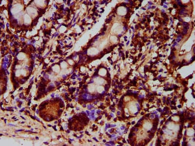 Polyclonal Rabbit anti-Human GPT2 / ALT2 Antibody (IHC, WB)