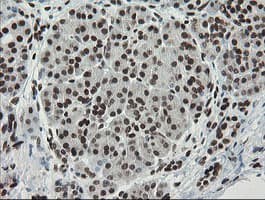 TLE1 / TLE 1 Antibody (aa180-460, clone OTI1H2, Carrier-free)