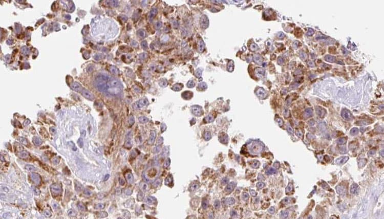 CTHRC1 Antibody (aa96-123)