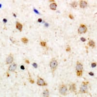 ADGRG6 / GPR126 Antibody (Internal)