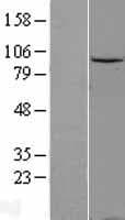 DDX20 / GEMIN3 Protein (Over-Expression Lysate Myc-DDK (Flag))