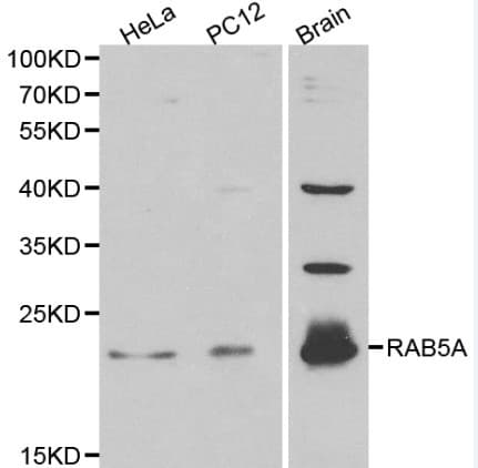 RAB5A / RAB5 Antibody