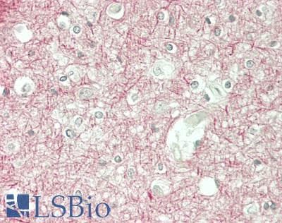 IHC-plus™ Polyclonal Rabbit anti-Human NBN / Nibrin Antibody (aa425-475, IHC, WB)