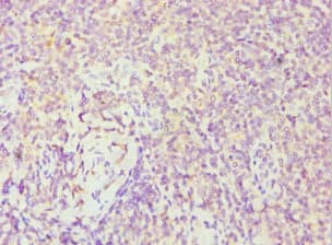FES Antibody (aa120-420)