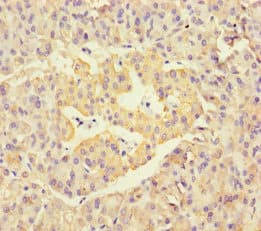 NEU1 / NEU Antibody