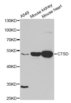 Polyclonal Rabbit anti-Human CTSD / Cathepsin D Antibody (IHC, IF, WB)