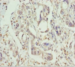 PPP1R8 / Rnase E Antibody