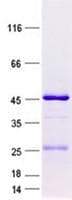 Human TCTEX1D1 Protein (Recombinant GST, N-terminus + His, C-terminus)