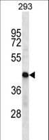 Polyclonal Rabbit anti-Human HSDL2 Antibody (aa229-258, WB)